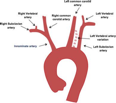 normal schematic diagram   aortic arch   great vessels