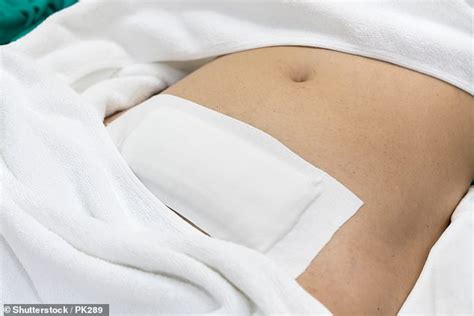 Hysterectomy By Keyhole That Spares A Womans Love Life Daily Mail Online