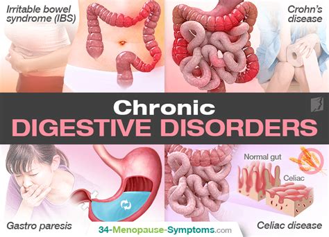 All About Chronic Digestive Disorder Menopause Now