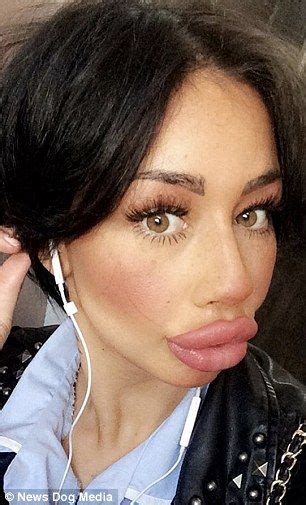 meet the mum who spent £2 000 on fillers for her dream trout pout