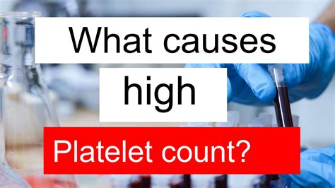 high platelet count   tsh