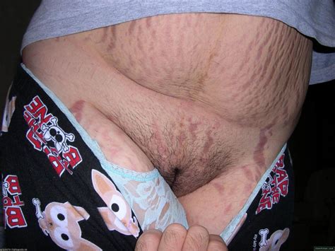 belly stretch marks porn hot porno