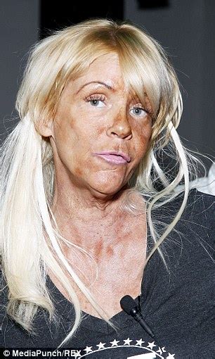 tan mom patricia krentcil has discovered botox and says