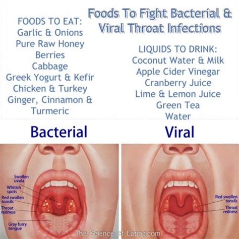 best ideas about viral sore throat remedies sore throat