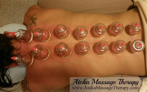 cupping therapy atoka massage therapy