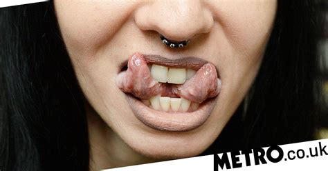 People Who Get Their Tongues Split Are Putting Their Lives At Risk