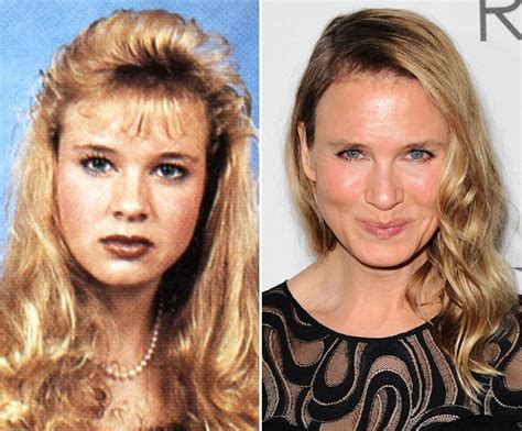 renee zellweger before plastic surgery — what her face