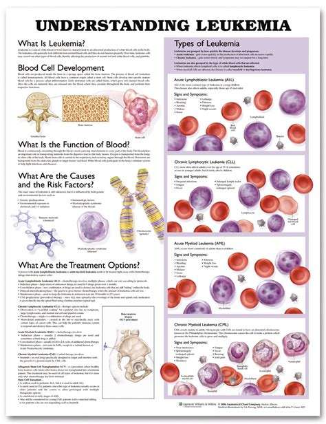 Understanding Leukemia Anatomical Chart Anatomy Models