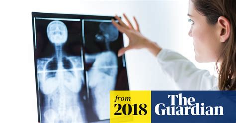 doctors hail world first as woman s advanced breast cancer is