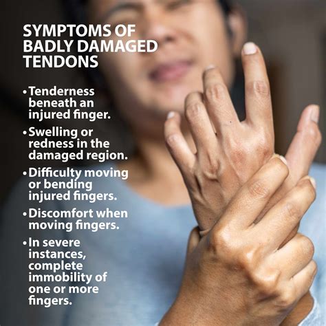 tendon transfers   hand florida orthopaedic institute