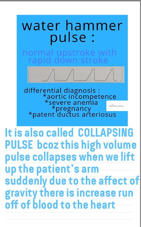 collapsing pulse   nursing school survival cardiology school survival