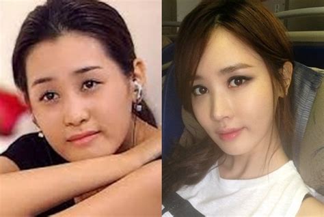 lee da hae plastic surgery before after breast implants