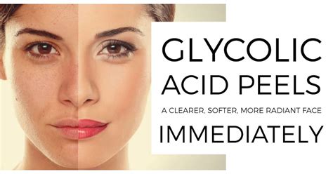 glycolic acid chemical peel kit anti aging anti wrinkle etsy