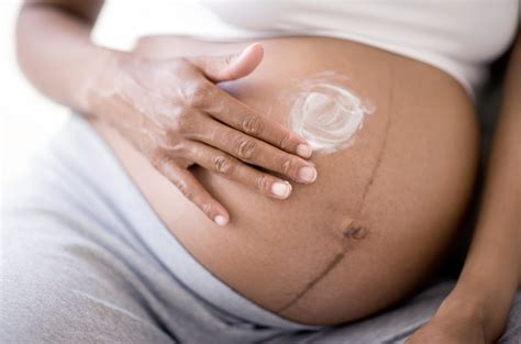 stretch mark creams moms swear by during pregnancy