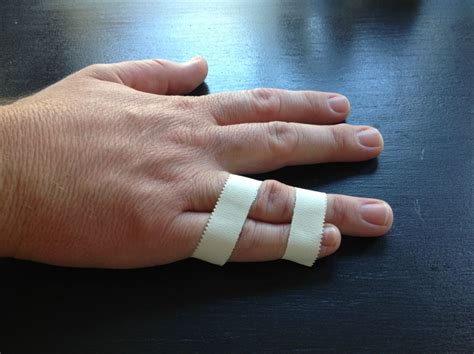 learn how to buddy tape a finger