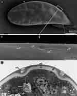 Afbeeldingsresultaten voor "trypetesa Lampas". Grootte: 150 x 188. Bron: www.researchgate.net