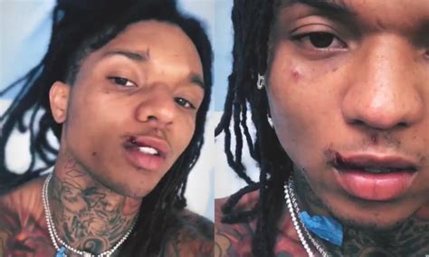 Fan Throws Phone On Stage At Swae Lee Splitting His Lip Open