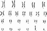 Chromosomes Karyotype Karyogram Cytogenetics Chromosome Xy Pathology Condensed Mitotic Homologous Muski Kod sketch template