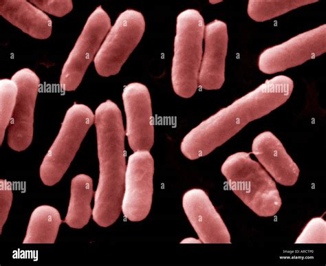 scanning electron micrograph  salmonella typhimurium dt  stock