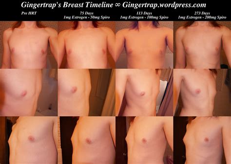 tranny breast development stages