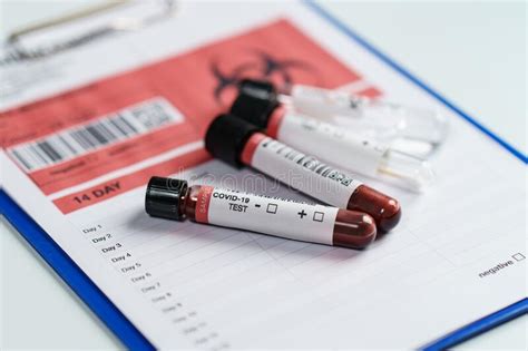blood test samples tube reagent testing tube  swab collection kit   laboratory
