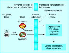 Onchocerciasis The Bmj