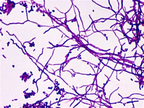 Microbiology Are Acid Fast Bacteria Gram Positive Or