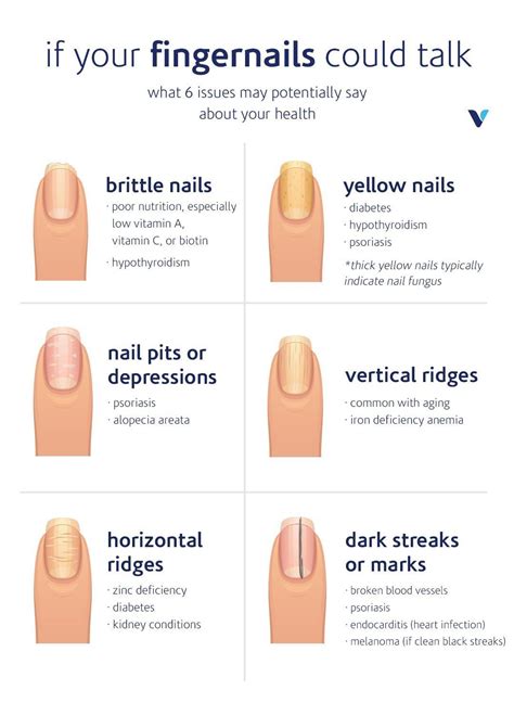 what your fingernails say about your health fingernail
