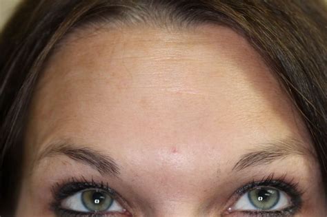 images  forehead  pinterest clogged pores beauty  smooth