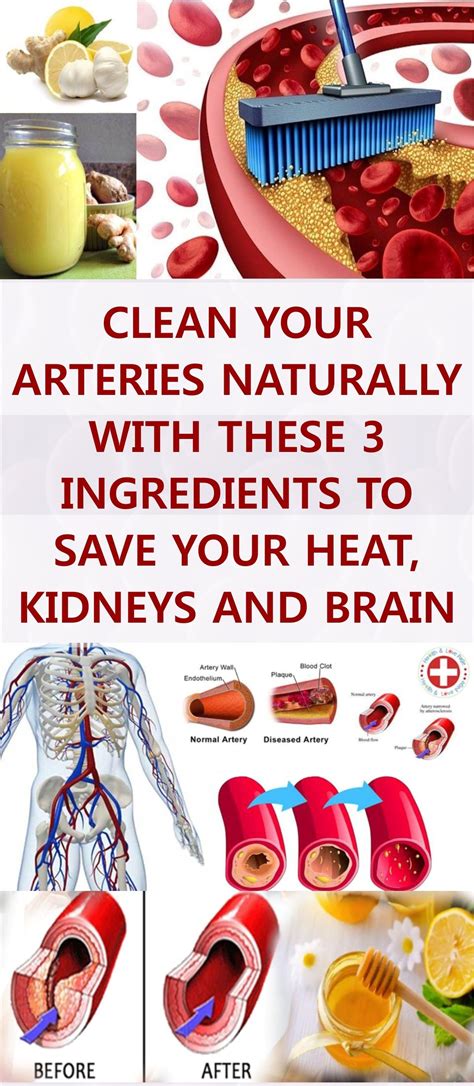 fine article about how to clean your arteries naturally with these 3