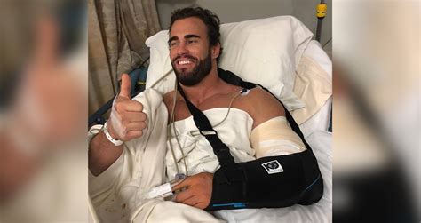 Calum Von Moger Gives Update After Successful Bicep