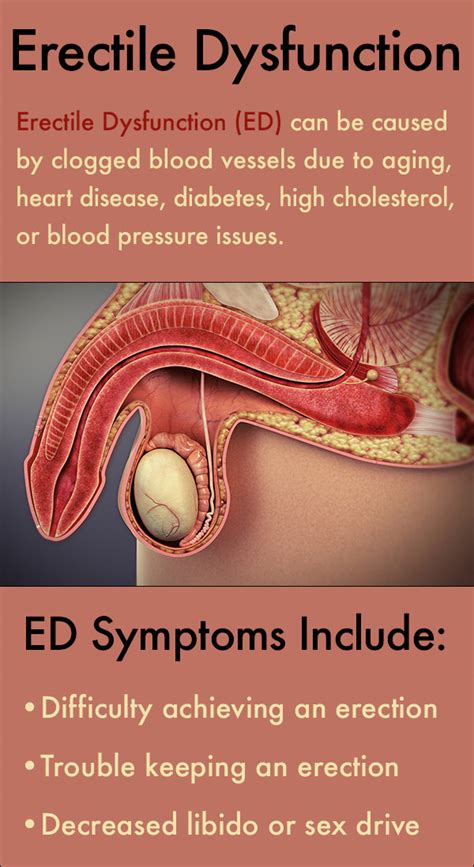 Erectile Dysfunction Treatment What Causes Ed Symptoms
