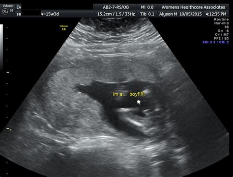 16 weeks pregnant gender online image arcade