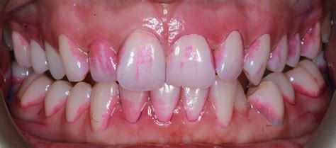 smile gallery rw perio specialist periodontal gum clinic in