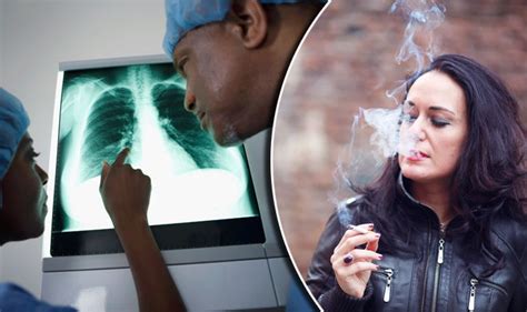 lung disease caused by smoking could cost nhs more than £2 billion