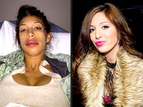 farrah abraham s lips back to normal following botched plastic surgery procedure