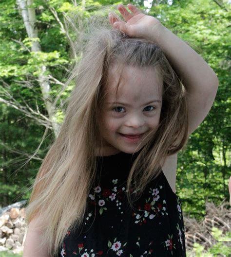 the unknown contributor beyond down syndrome