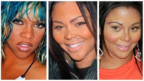 Lil Kim Plastic Surgery Before And After Breast Implants
