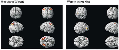 figure 1 from sex differences in brain activation pattern during a