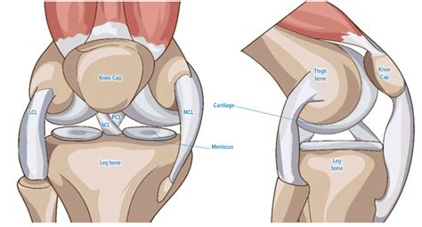 Knee Replacement Surgery Phoenix Spine And Joint