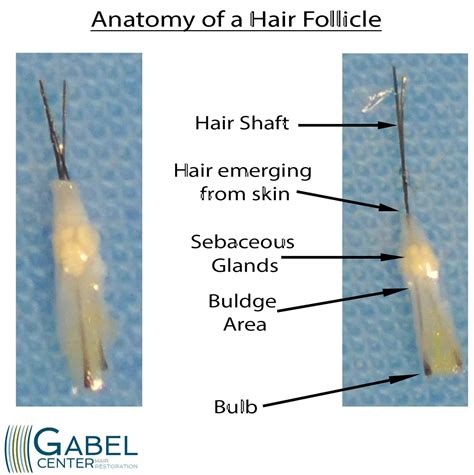 hair follicle anatomy gabel center