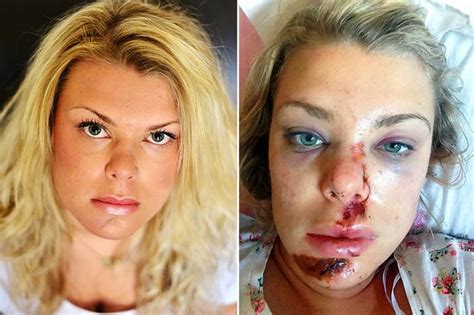 woman s horrific injuries after being punched by taxi driver following row over fare mirror online