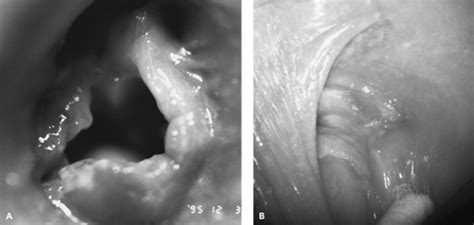 forensic examination of the sexual assault victim obgyn key