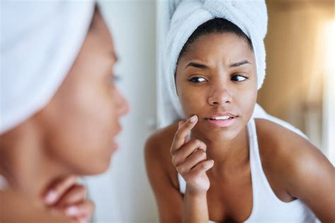 cystic acne treatments for darker complexions essence
