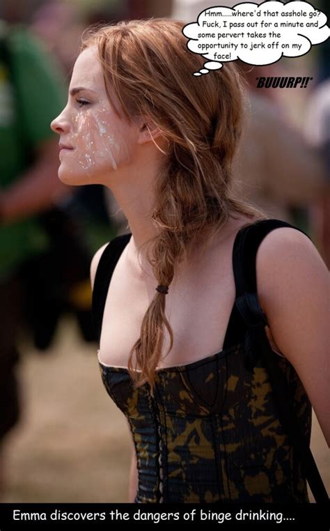 Emma Watson With Braid And Fake Facial Jsc