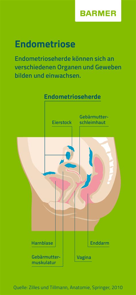 endometriose symptome psyche