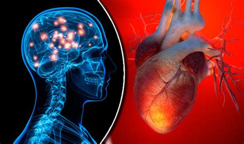Stroke Diet Red Wine And Olive Oil Among Foods That