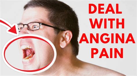 deal  angina pain definition types   treatment youtube