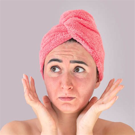 chemical peel  wrong risks  side effects