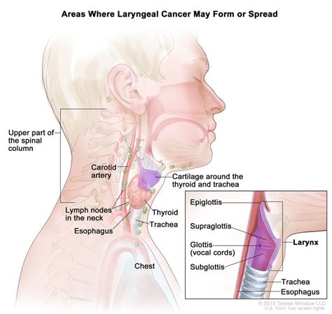laryngeal cancer treatment adult pdq® patient version nci